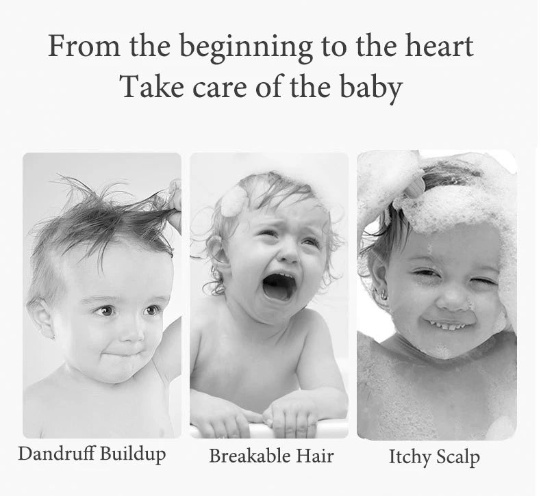 Three infants and toddlers with dandruff, breakable hair, itchy scalp; personalized wooden brush and comb.